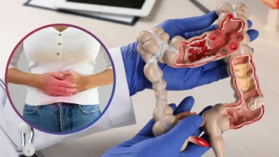 Genetik faktörler, obezite, düzensiz beslenme, sigara ve hareketsiz yaşam tarzı