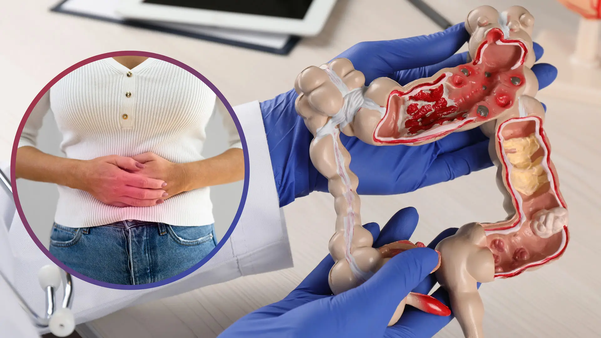 Genetik faktörler, obezite, düzensiz beslenme, sigara ve hareketsiz yaşam tarzı